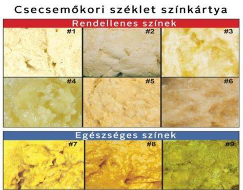 Csecsemő normális széklet színek