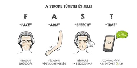 stroke tünetei arc kar beszéd