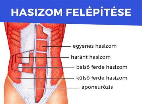 terhességi hasfal és szétnyílt hasizom
