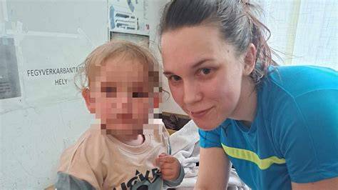 16 hónapos gyermek száraz, hámló fejbőre