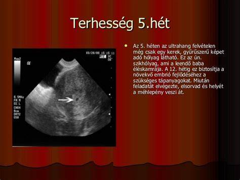 6 hetes embrió ultrahangvizsgálata